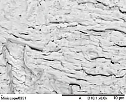 ストライエーション